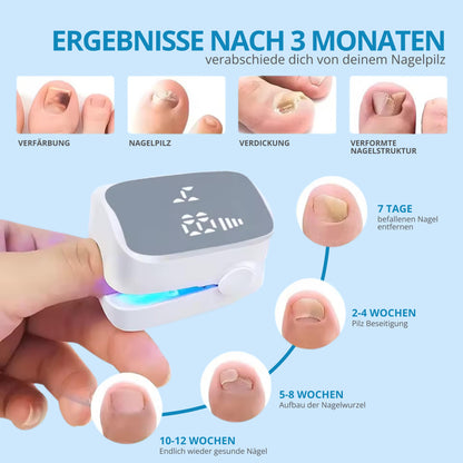 NailCure®  Nagelpilz-Entferner